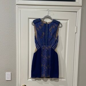 Elegant Blue Lace Dress